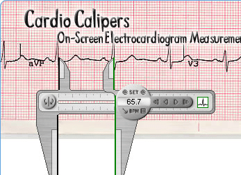 Cardio Calipers Screenshot 1
